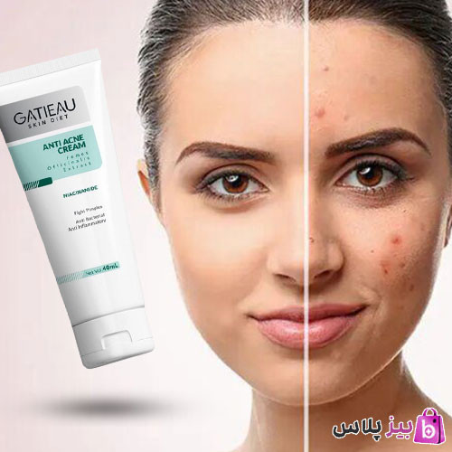 کرم بیوممتیک ژلی آنتی آکنه ضدجوش و ضدلک گاتیو ایتالیا
